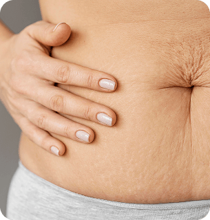 устранение последствий разрывов и рубцов после родов или операций