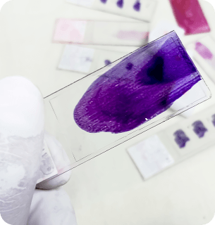 патологическая верификация удаленных тканей (по показаниям)