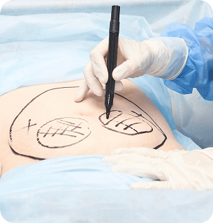 Отточенные протоколы лечения, индивидуальный подбор параметров