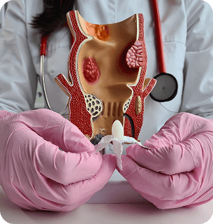 Современные методы лечения геморроя, анальных трещин и других заболеваний