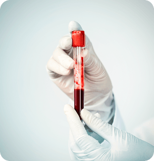 Коррекция нарушений гемостаза, возникающих на фоне применения различных методов ВРТ